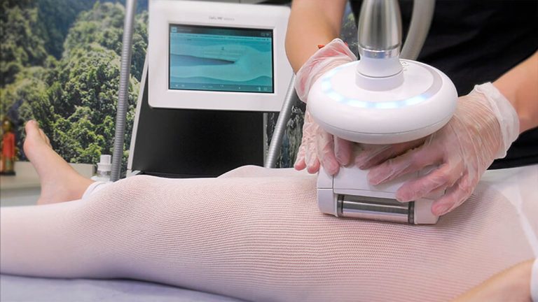 LPG Endermologie