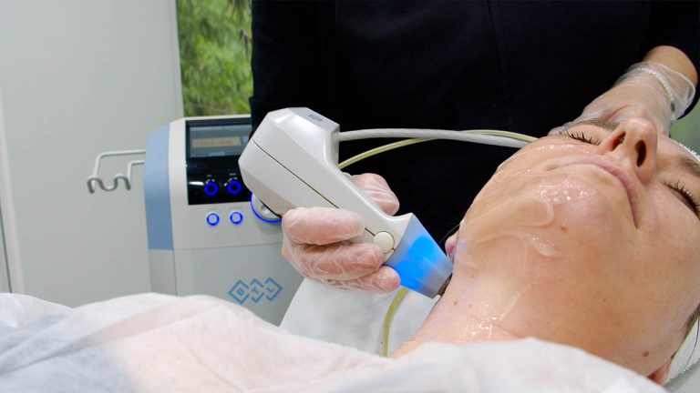 Radiofrecuencia BTL-Exilis